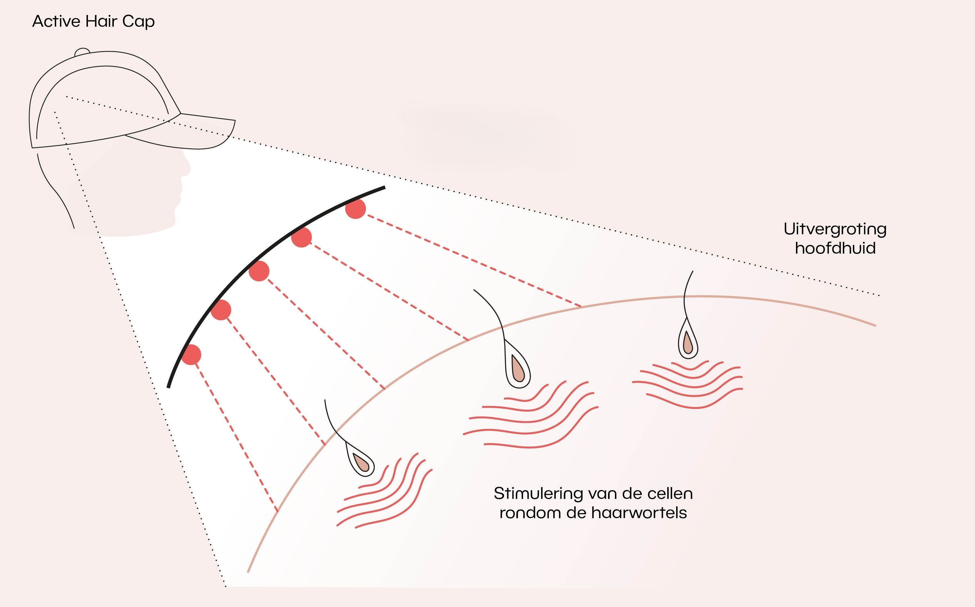 Lasertherapie voor haargroei: Wat gebeurt er écht onder je huid?
