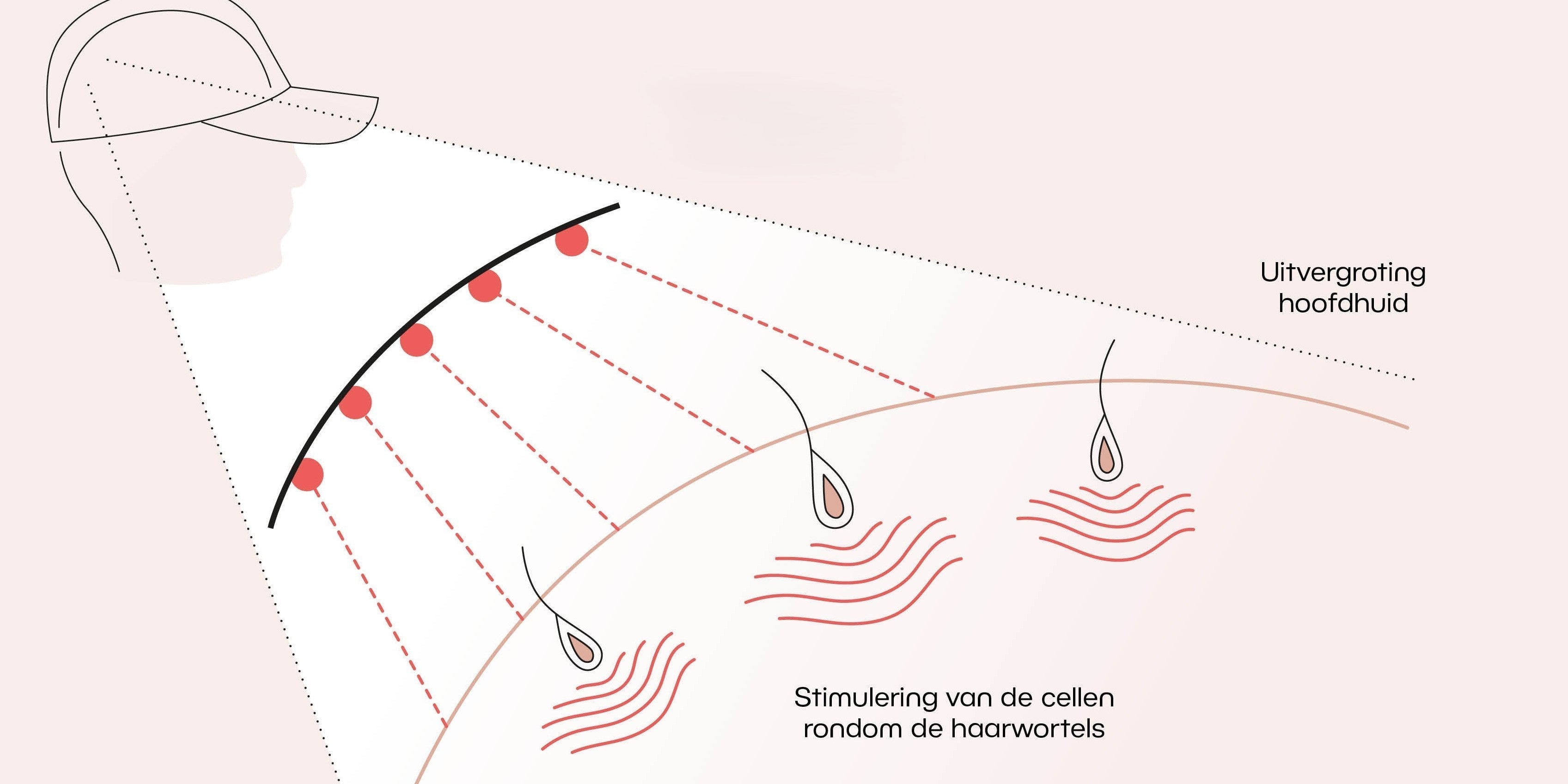 Lasertherapie voor haargroei: Wat gebeurt er écht onder je huid?
